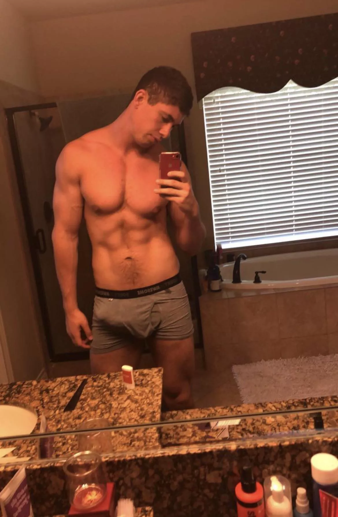 Should I take these off? posted by Jackpackage71