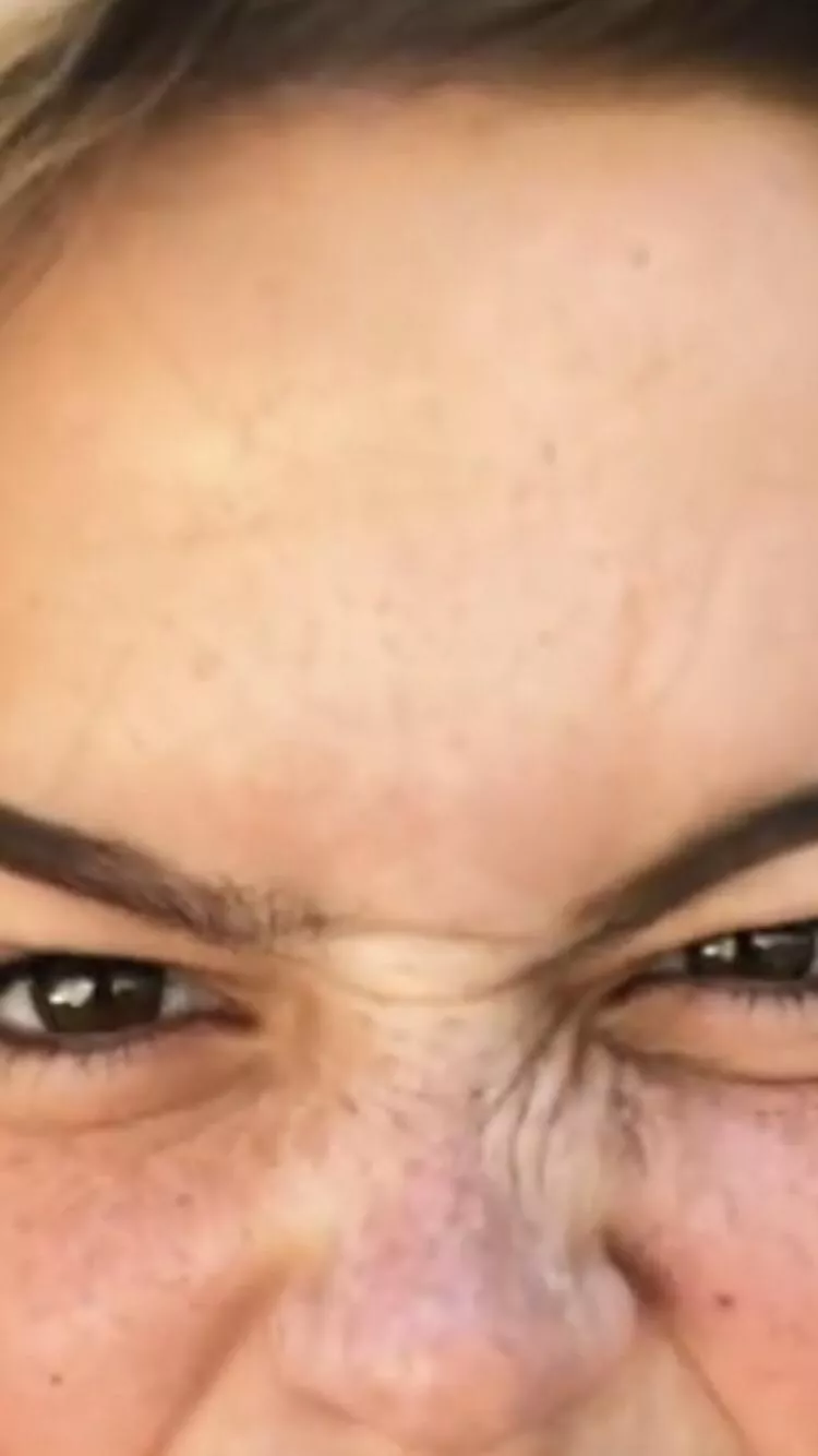 Showing my forehead freckles for master posted by achillesdegreat