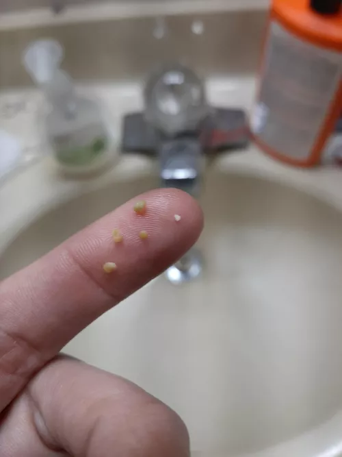 since I moved I've been finding these every so often. (I think they're being caused by mold) by sneakysquirrel93