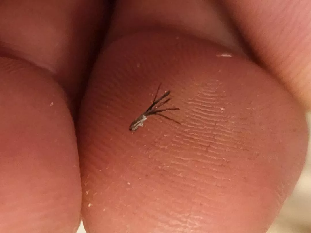 Small pop of the neck was hiding the ultra super mega hair posted by pabloneedsanewanus