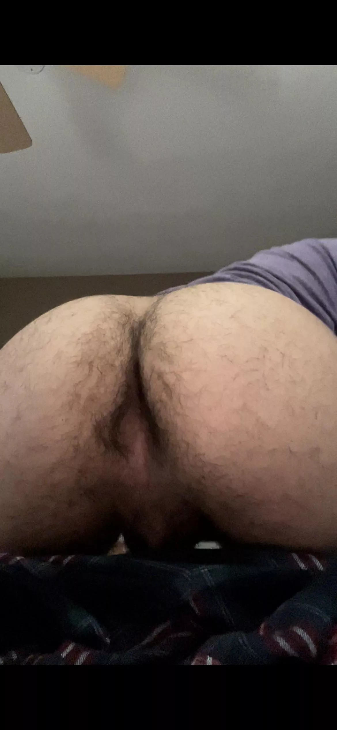 So hairy [19] posted by Better_Scheme3982