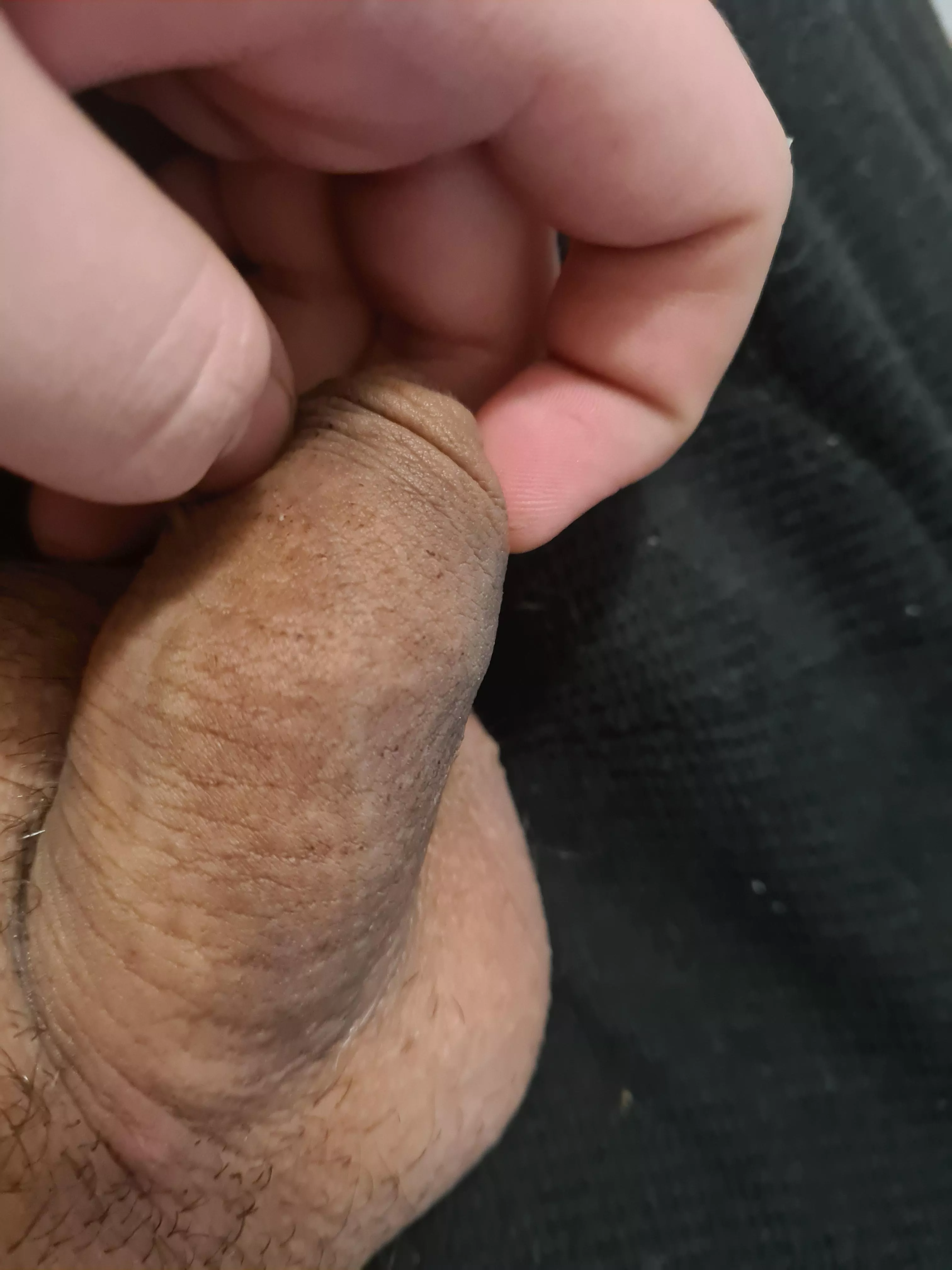 So I haven't pumped for about a week because my skin turned kinda dark after peatchie but for so reason it's not going away any tips on how to get rid of it ? posted by No_Afternoon_4506