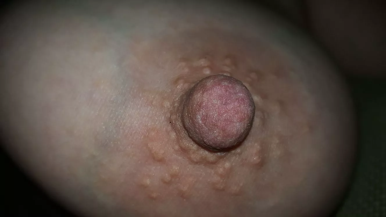 So sensitive now posted by Robalex70