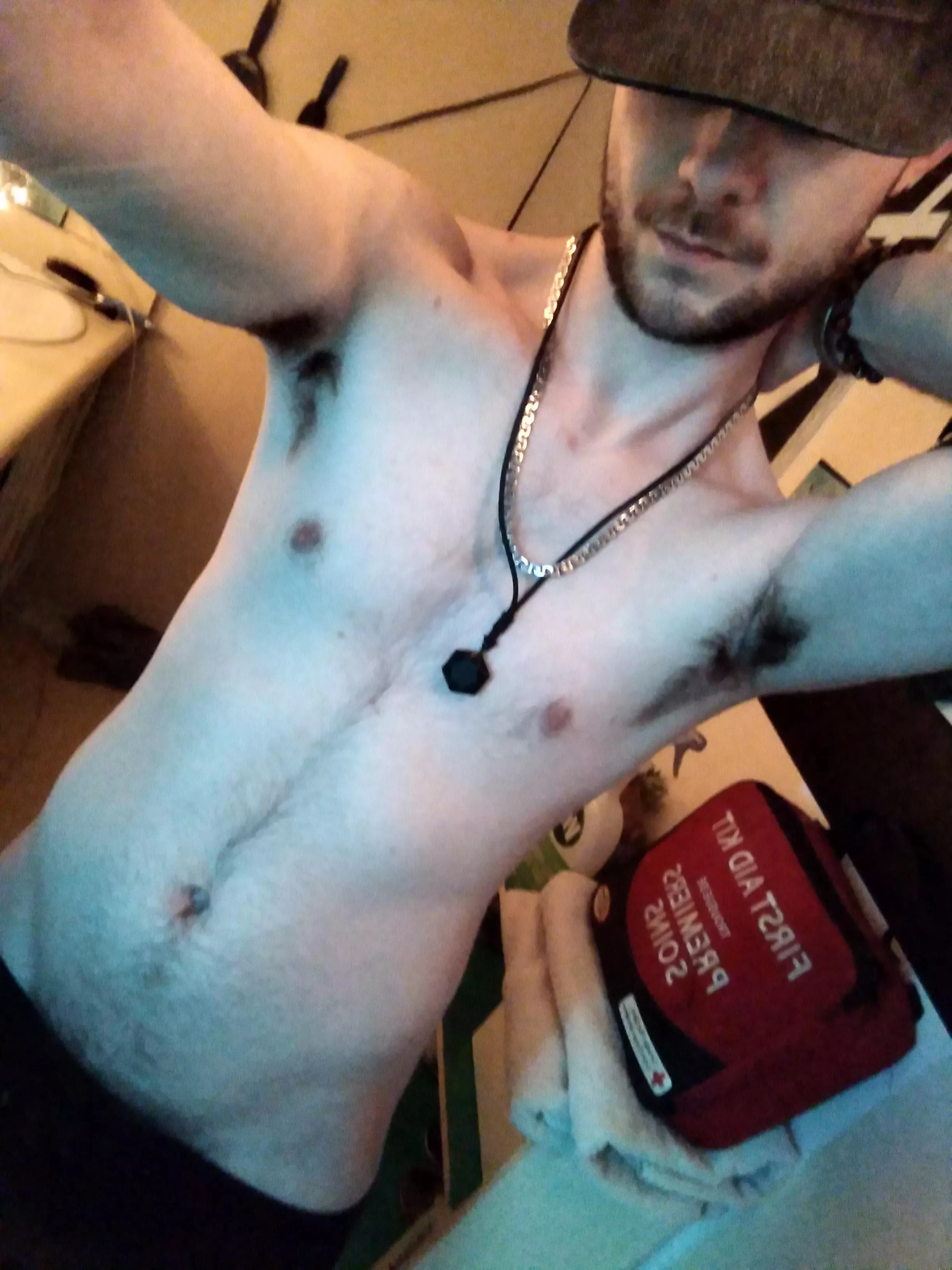 so spent 10 mins staring at a blank title/caption😅🖕🏻📴. posted by sk_8yr9719ac