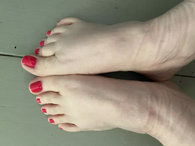 Socks were waaay too tight today by Comeasyouare22