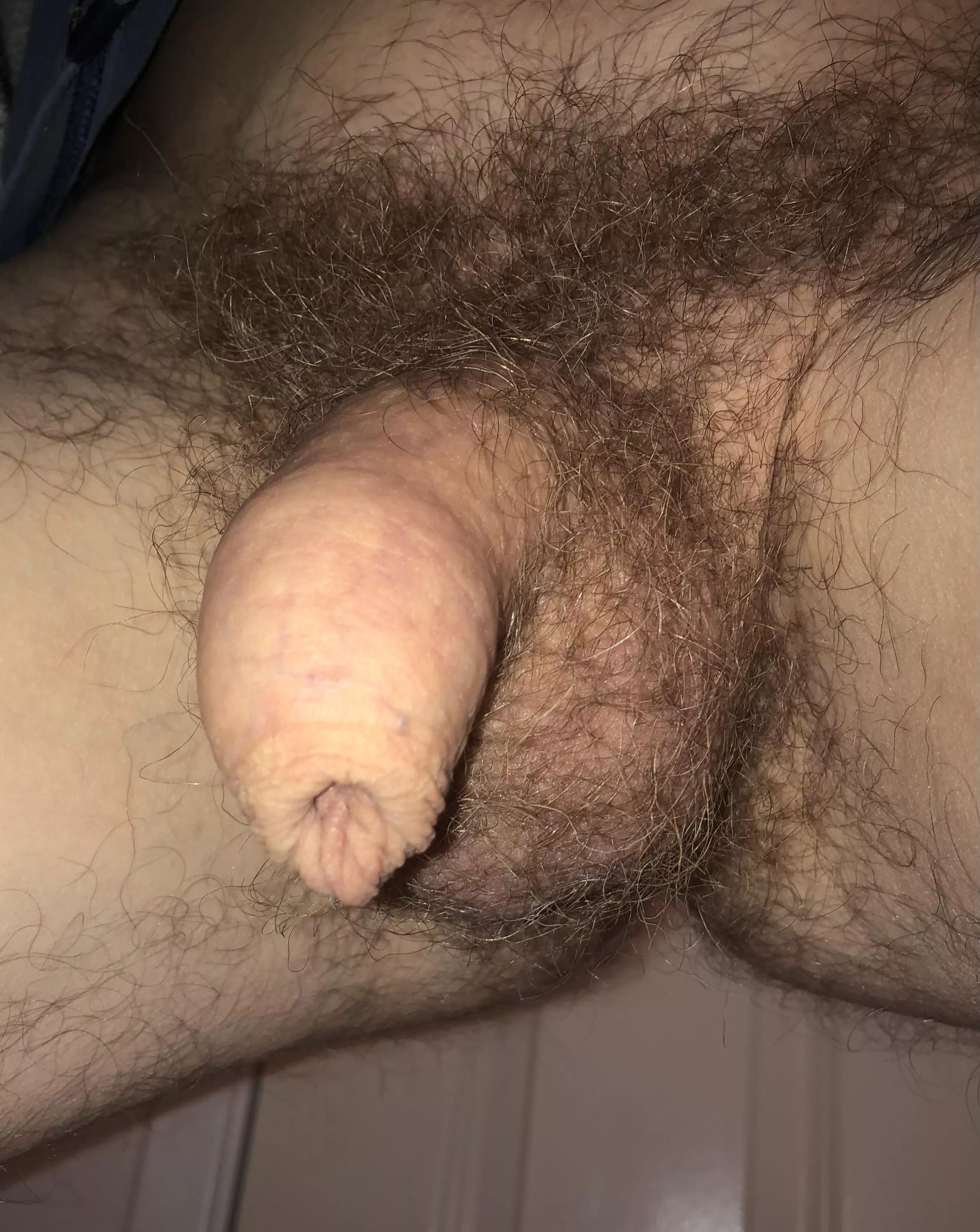 Soft and hairy posted by restoredforeskin