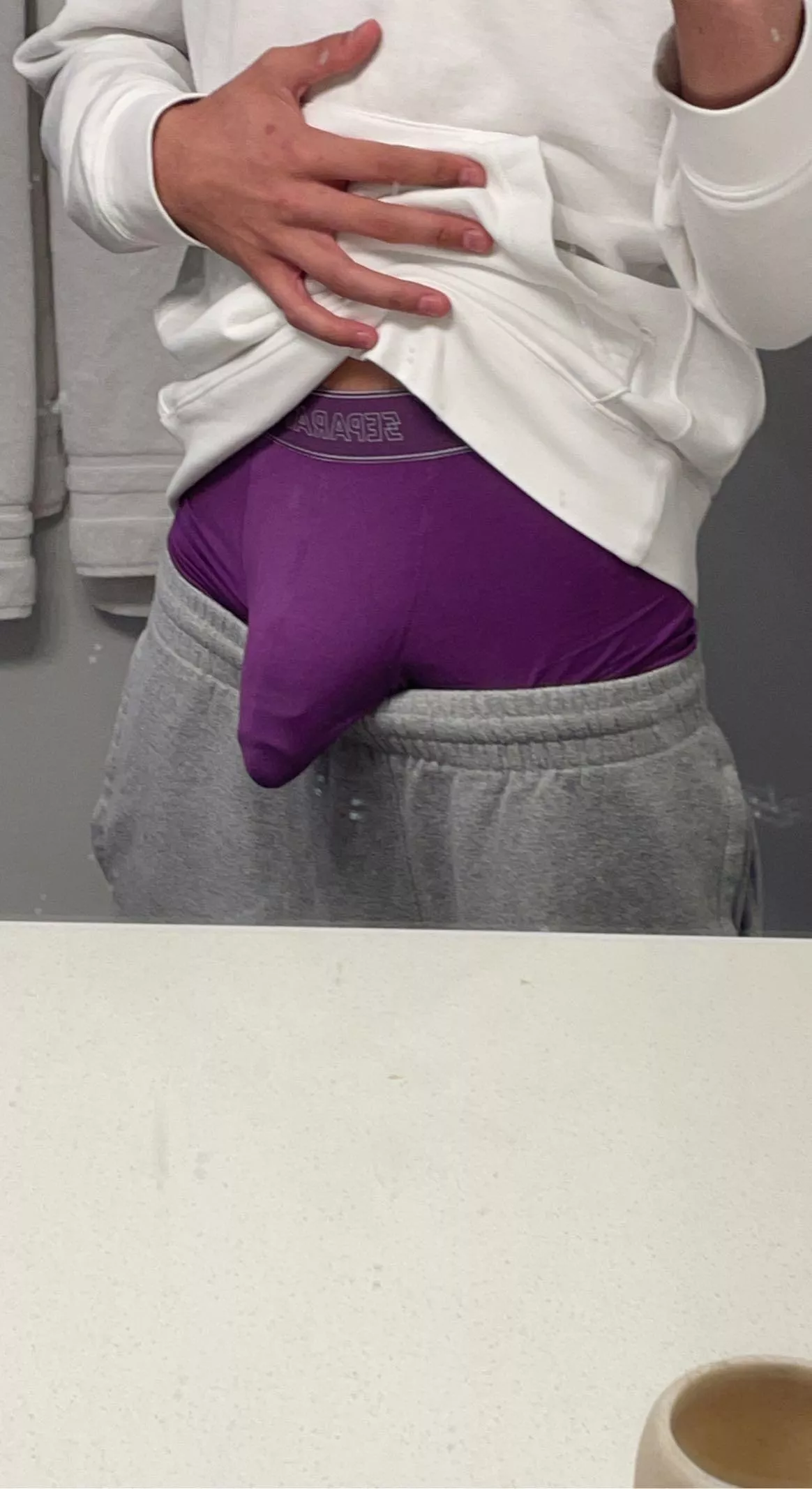 Soft but still see the veins posted by Bubbly-Basket4042