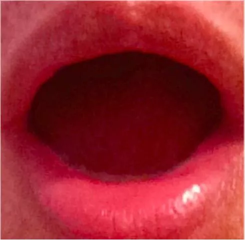 Soft wet hungry mouth horny for cock in West Palm Beach, Fl.. posted by Von-ruiz