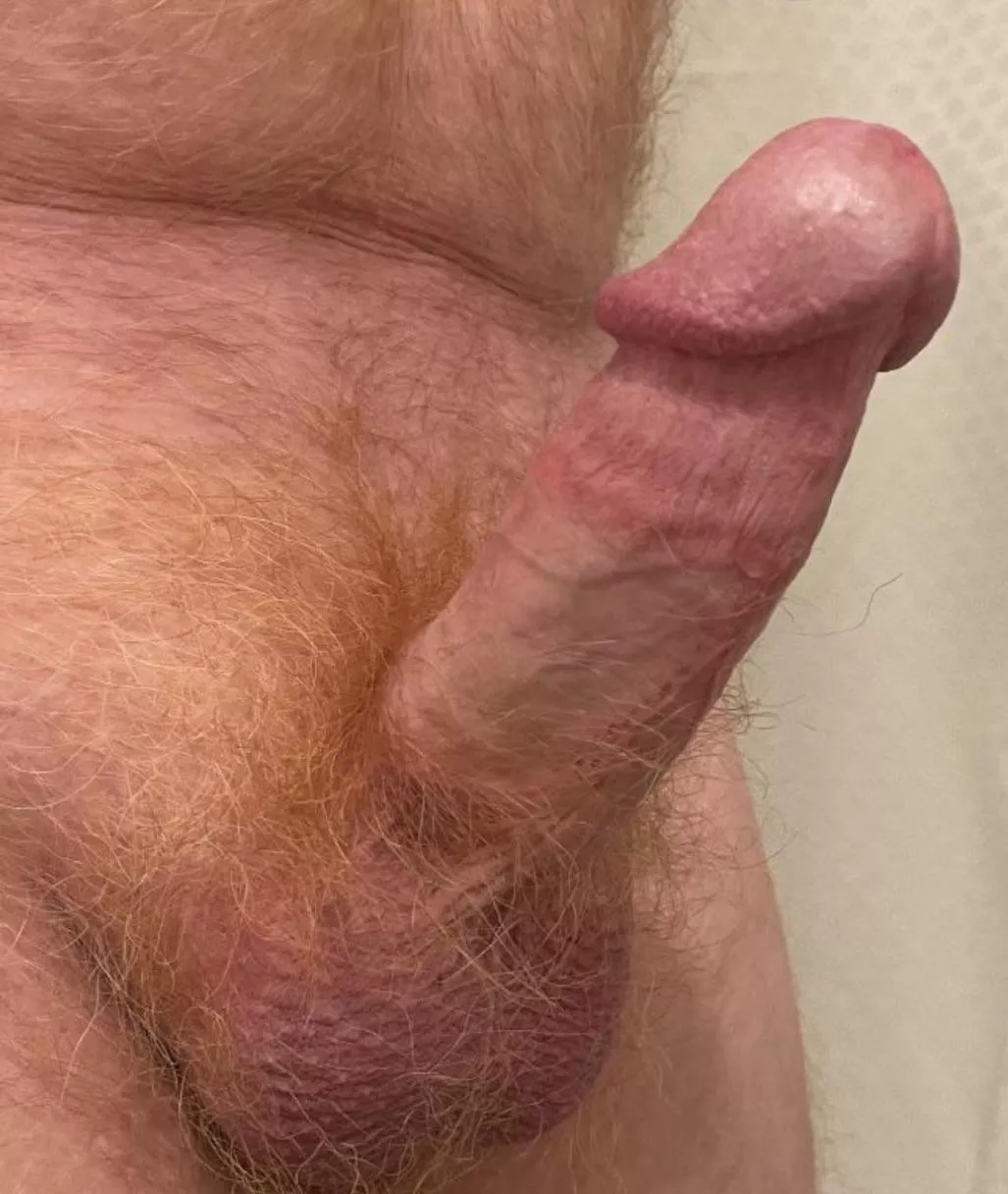 Some fiery Ginger pubes for you posted by Lkggood50
