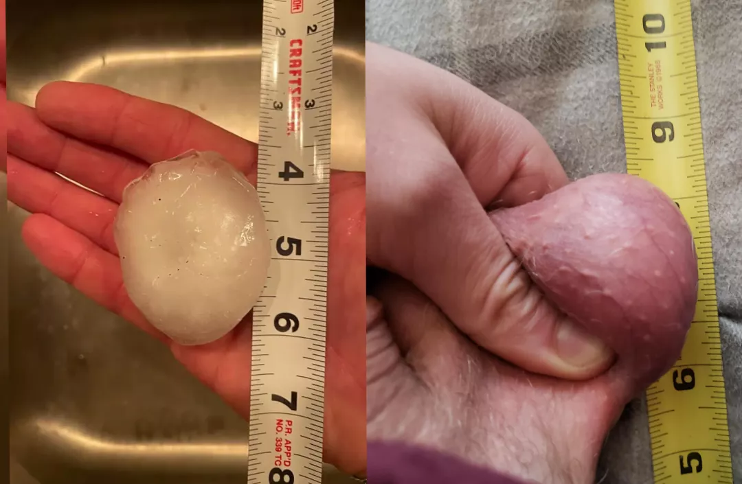 Some hail fell here last night and people are saying how massive it is. It is the same size as my each of my balls! Weird to see a close comparison posted by Marjohh