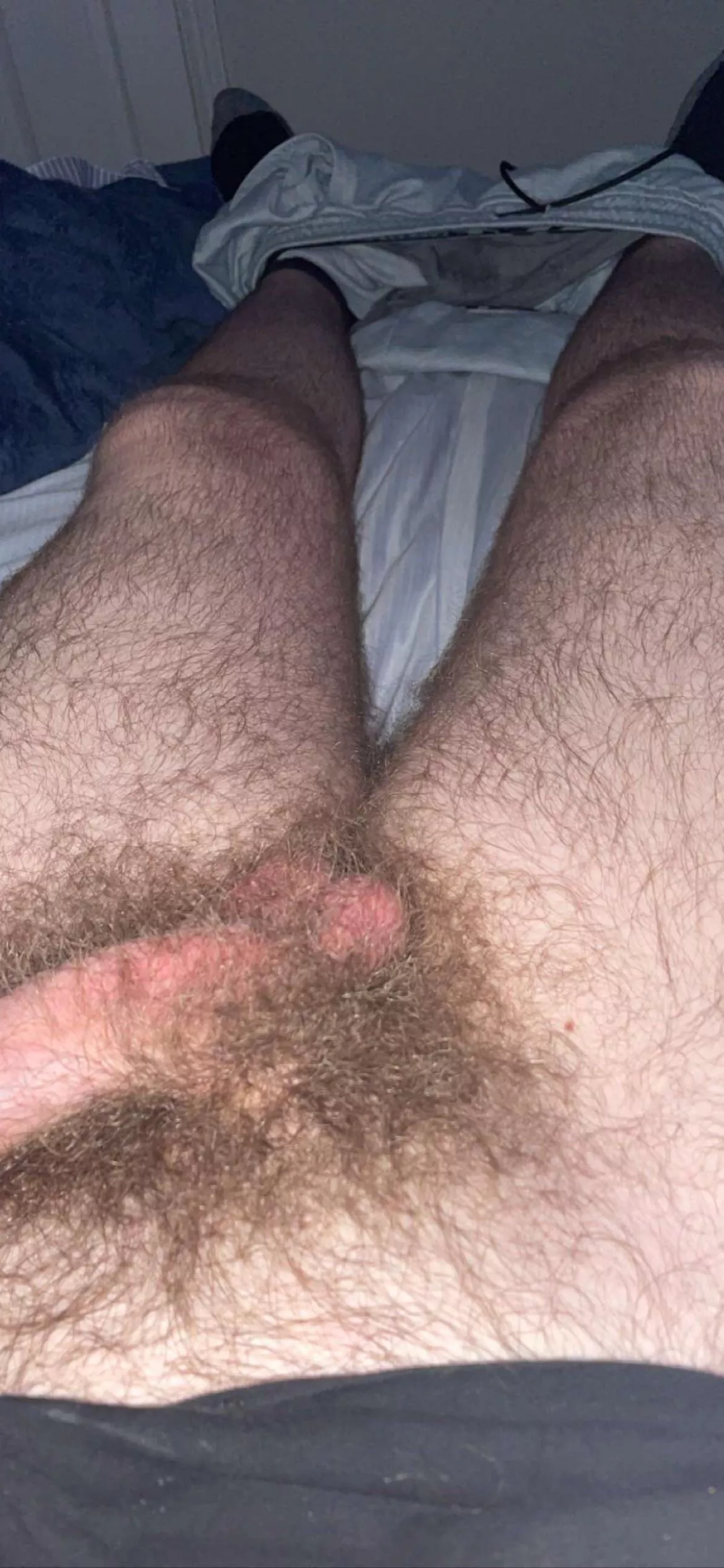 Someone said I should shave them. Should I? posted by Wild_Jc