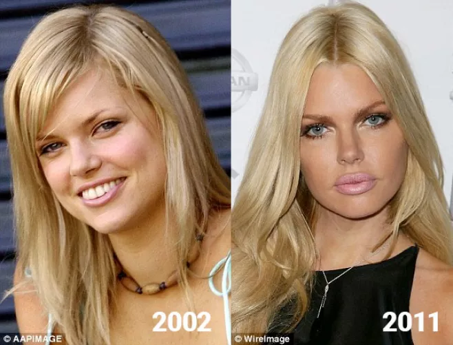 Sophie Monk, 9 years apart by RickStudly