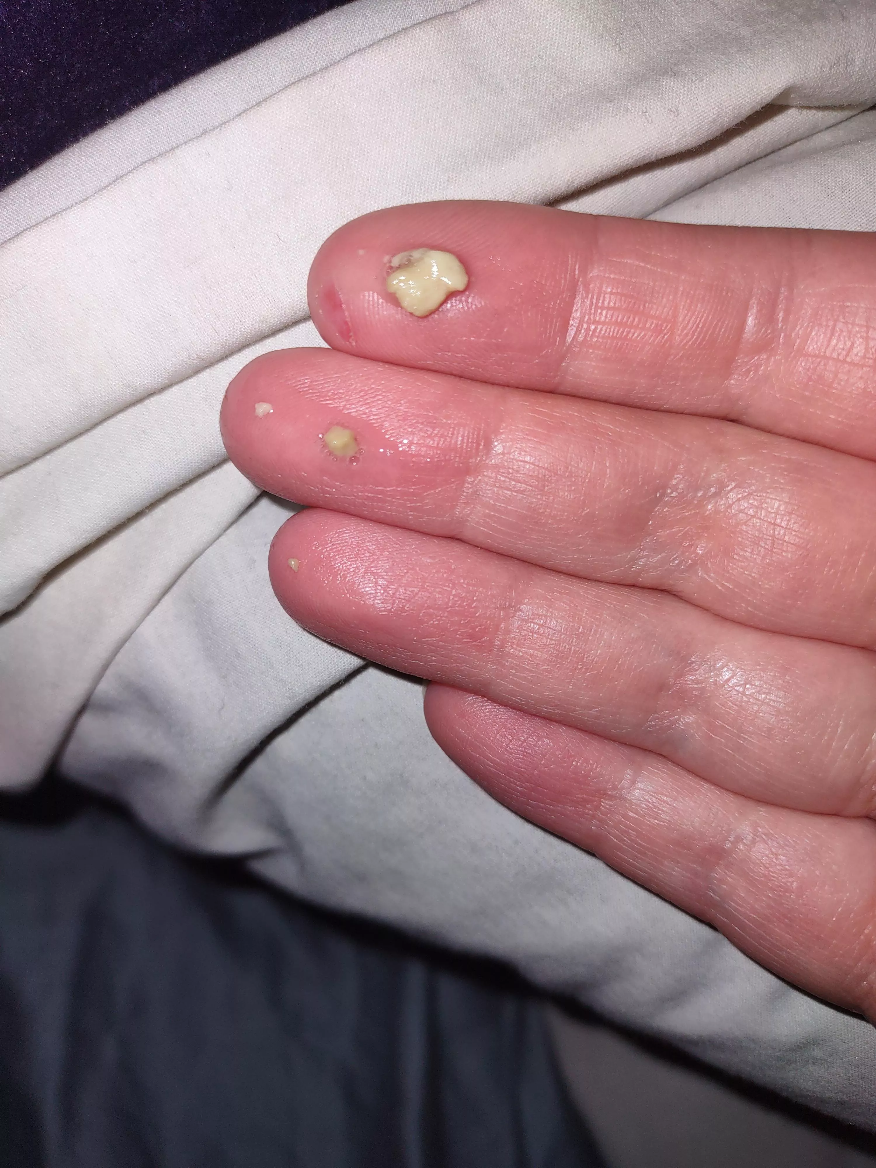 spit up a huge tonsil stone as i was trying to sleep 😭 it smelled so bad yall posted by johnnybird95