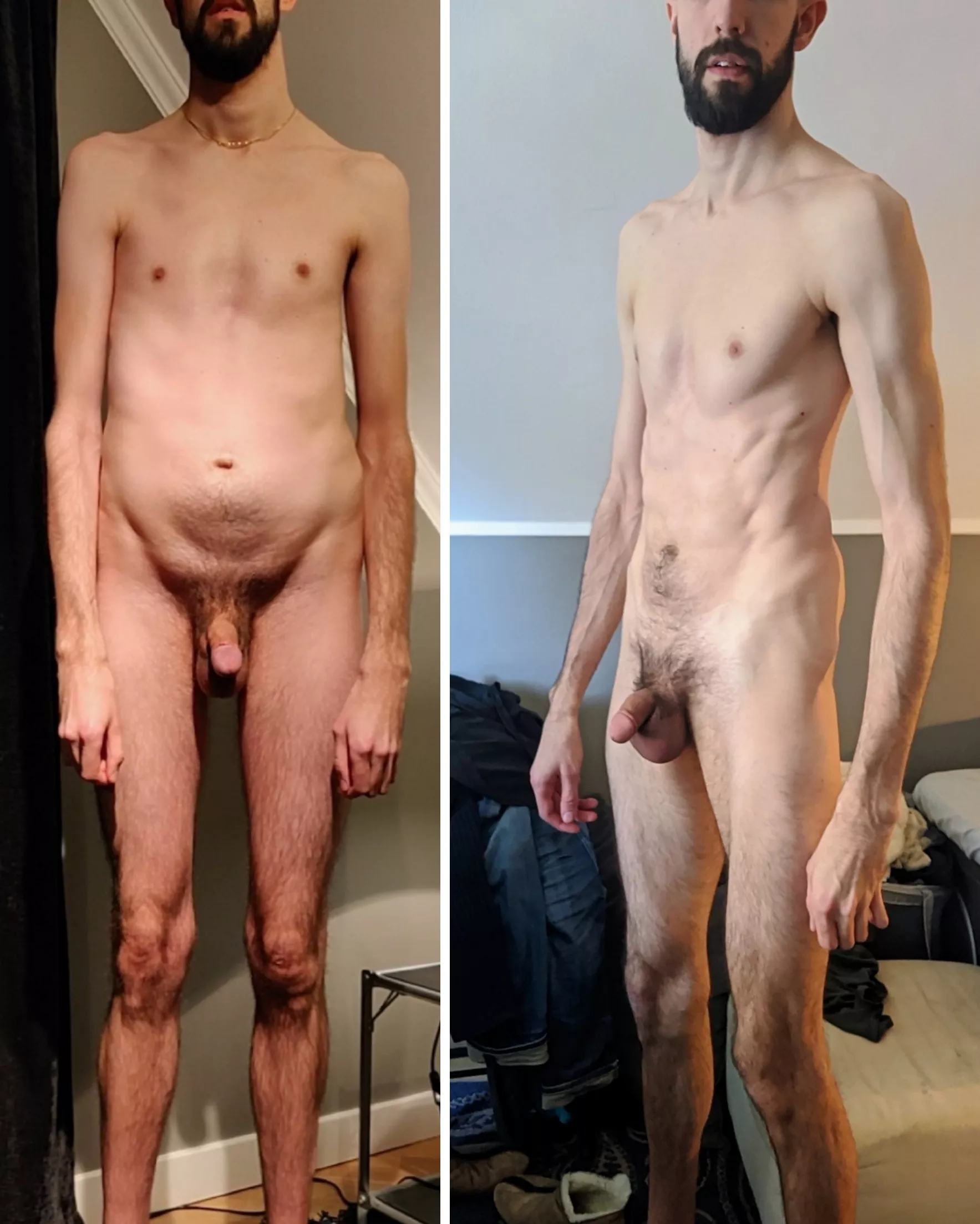 Started making changes at 27, now I'm 30 and I always need to look back to remember where I started to not lose hope. Weight is about the same in both pictures. Oh and I have Marfan's Syndrome in case you were wondering posted by lessthanthirteen