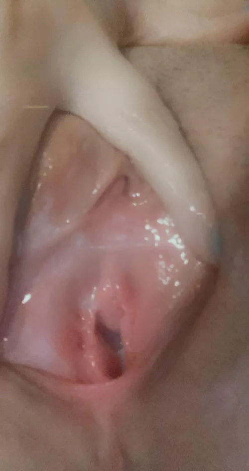 Stretched and filled by XxDestinyRainxX