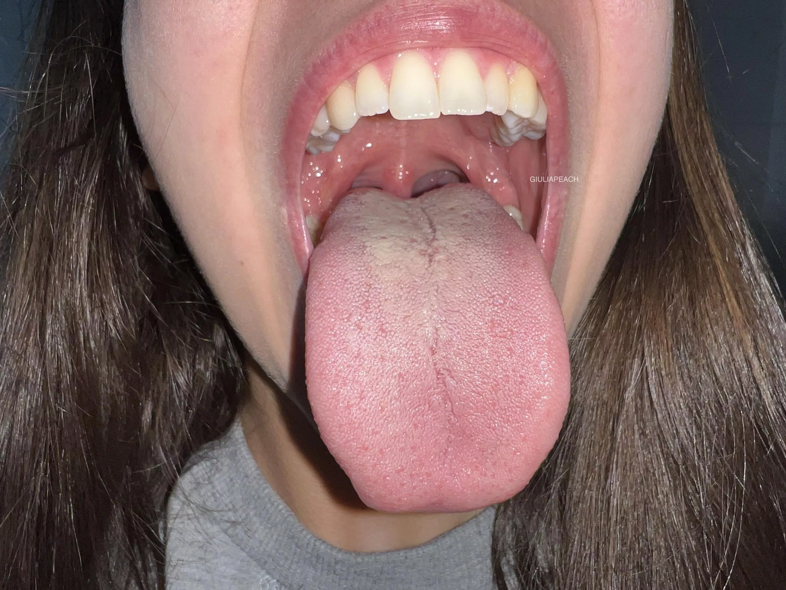 Such a big mouth posted by giuliapeach