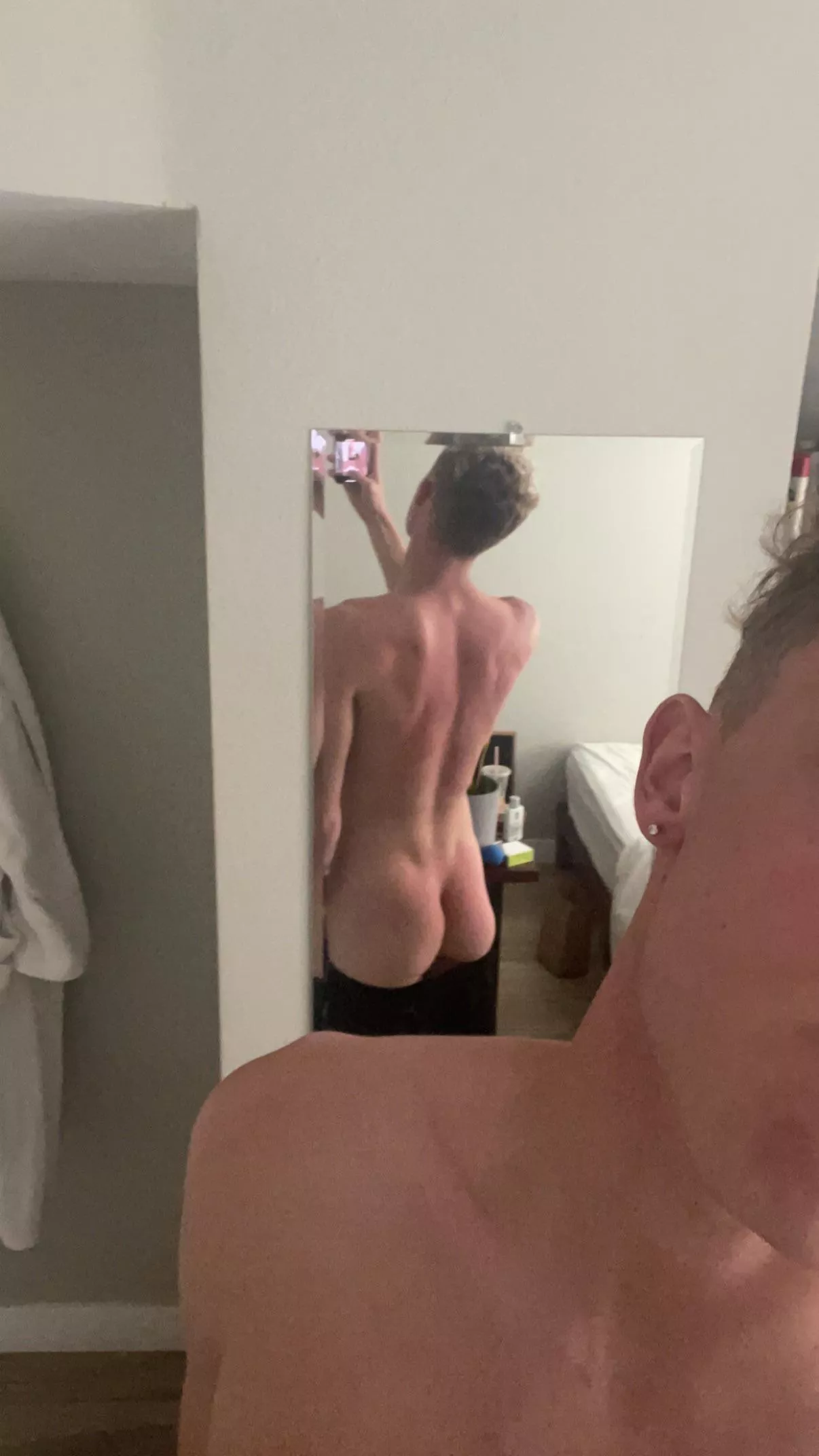 Sun burns 🥲 posted by Vero_Monroe