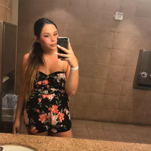 Sunburnt all over😩 22f by Training-Way5567