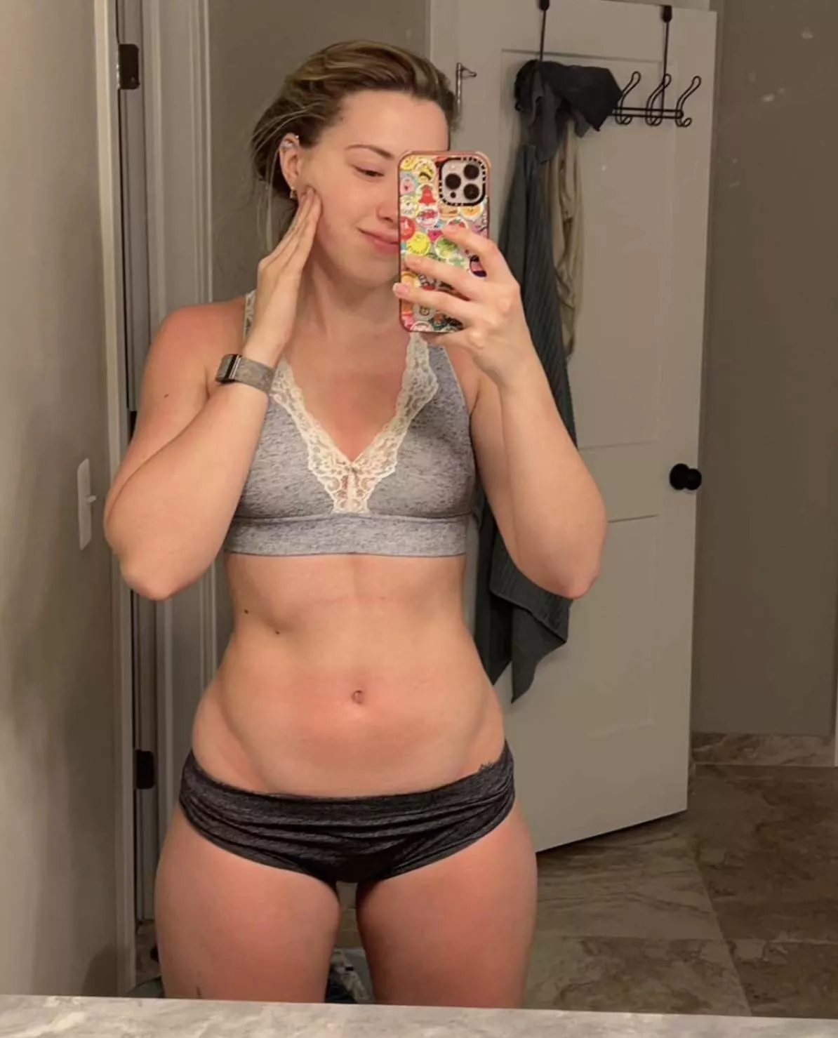 Sunburnt posted by SaintLex