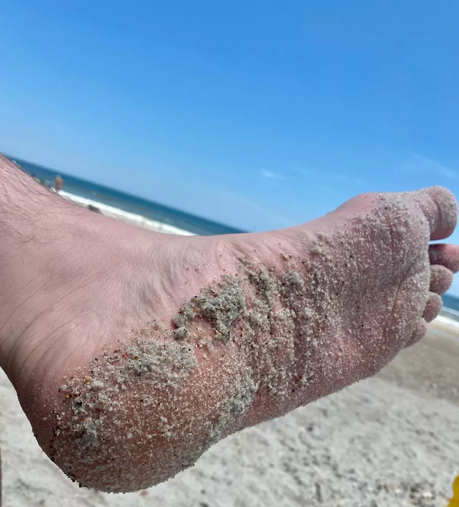 Sunday funday. Size 16s at the beach. posted by thatinterestingguy