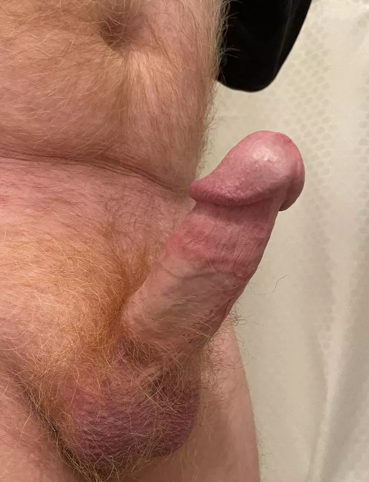 Swollen head posted by Lkggood50