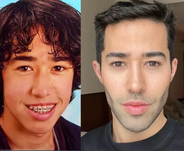 Teenage years were tough 😂 by Davh92