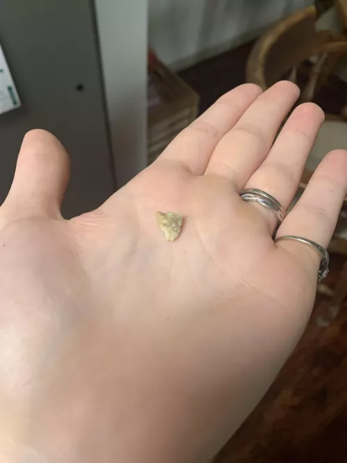 The aliens didn’t build the pyramids…MY TONSILS DID by ErmahgerdFearn