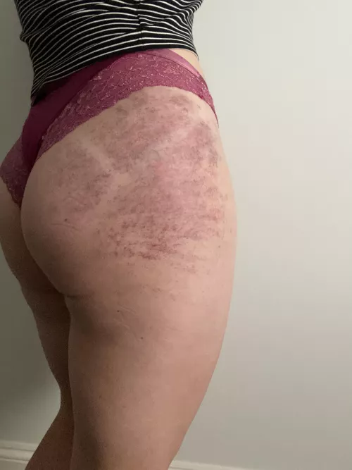 The morning after… by Fl0ss13