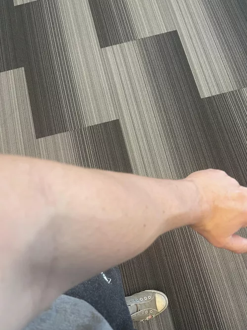 The non dominant arm… by Indythrowaway22