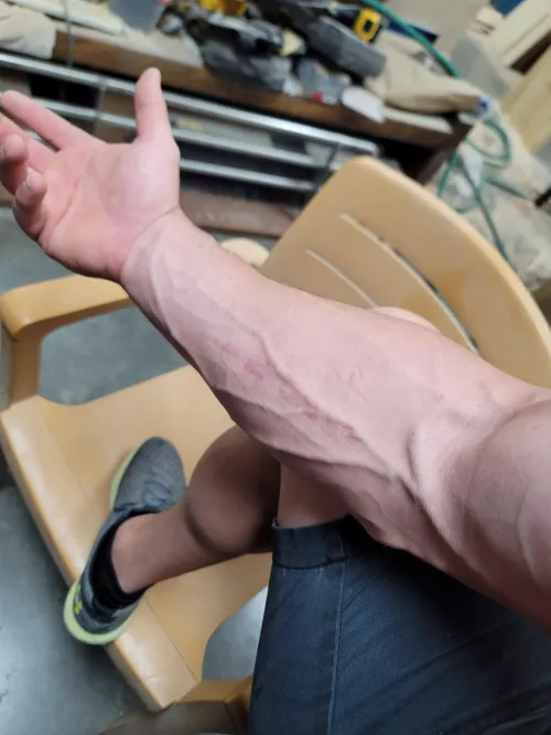 The scar ruins the look but i still enjoy the veins by C-x-r