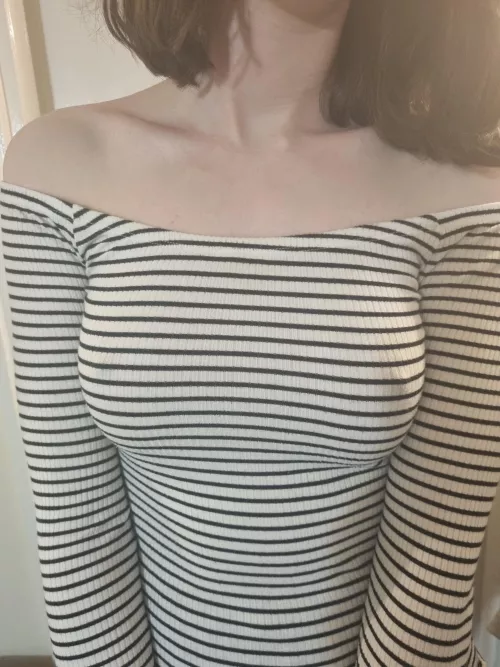 They're pretty prominent today 😁 by Ok-Vermicelli-3743