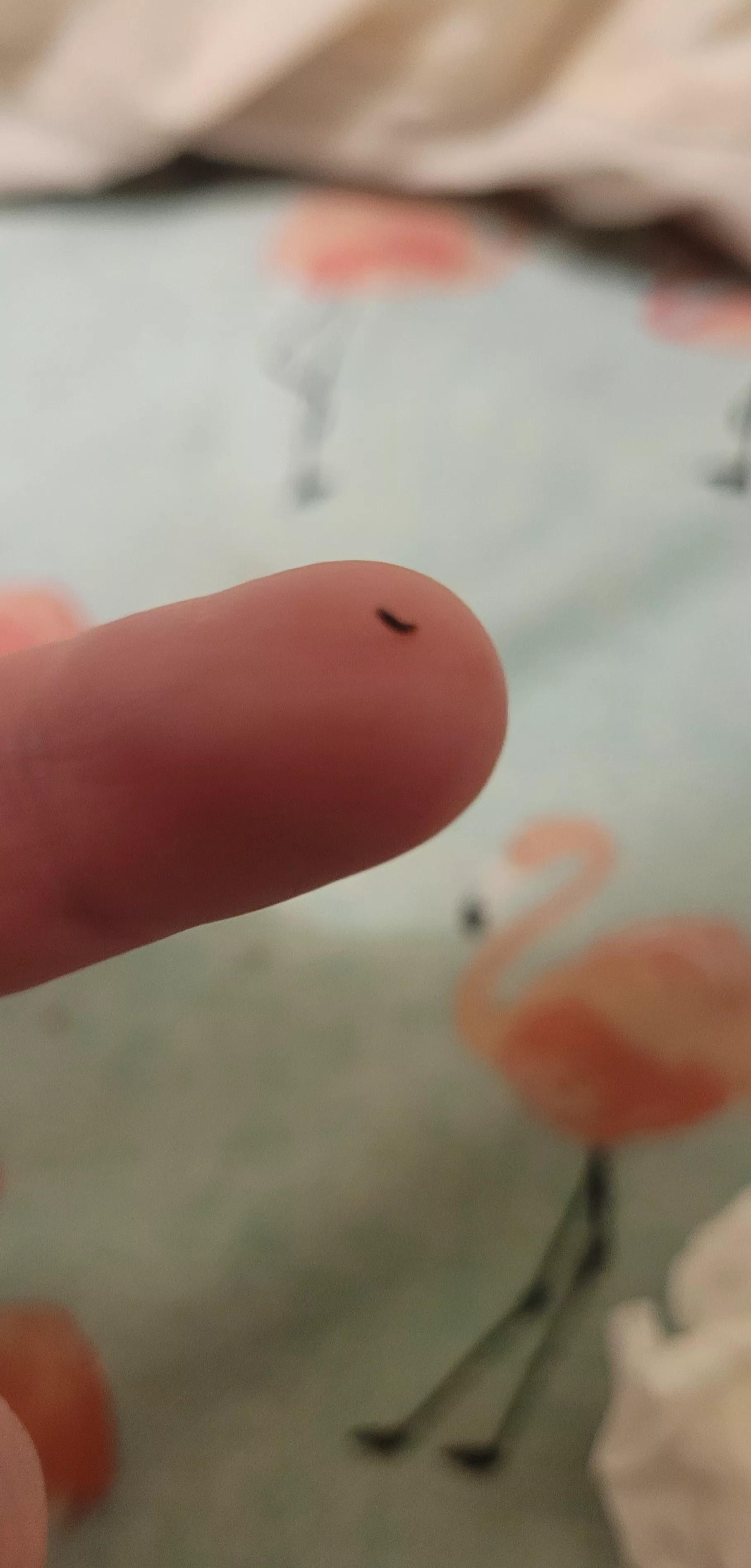 This blackhead just came out of my coochie (OC) posted by Little_Enby_Bean_96