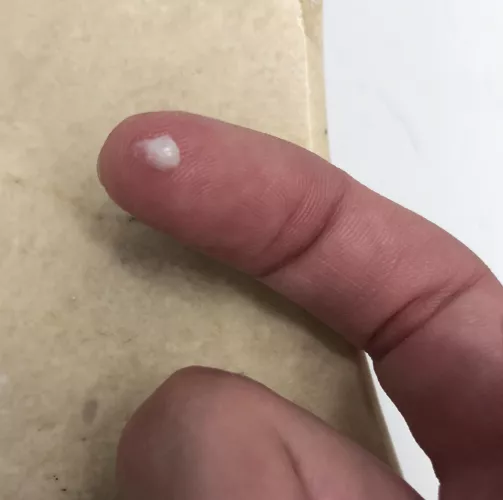 this came out of my eye??? by awkward-comics