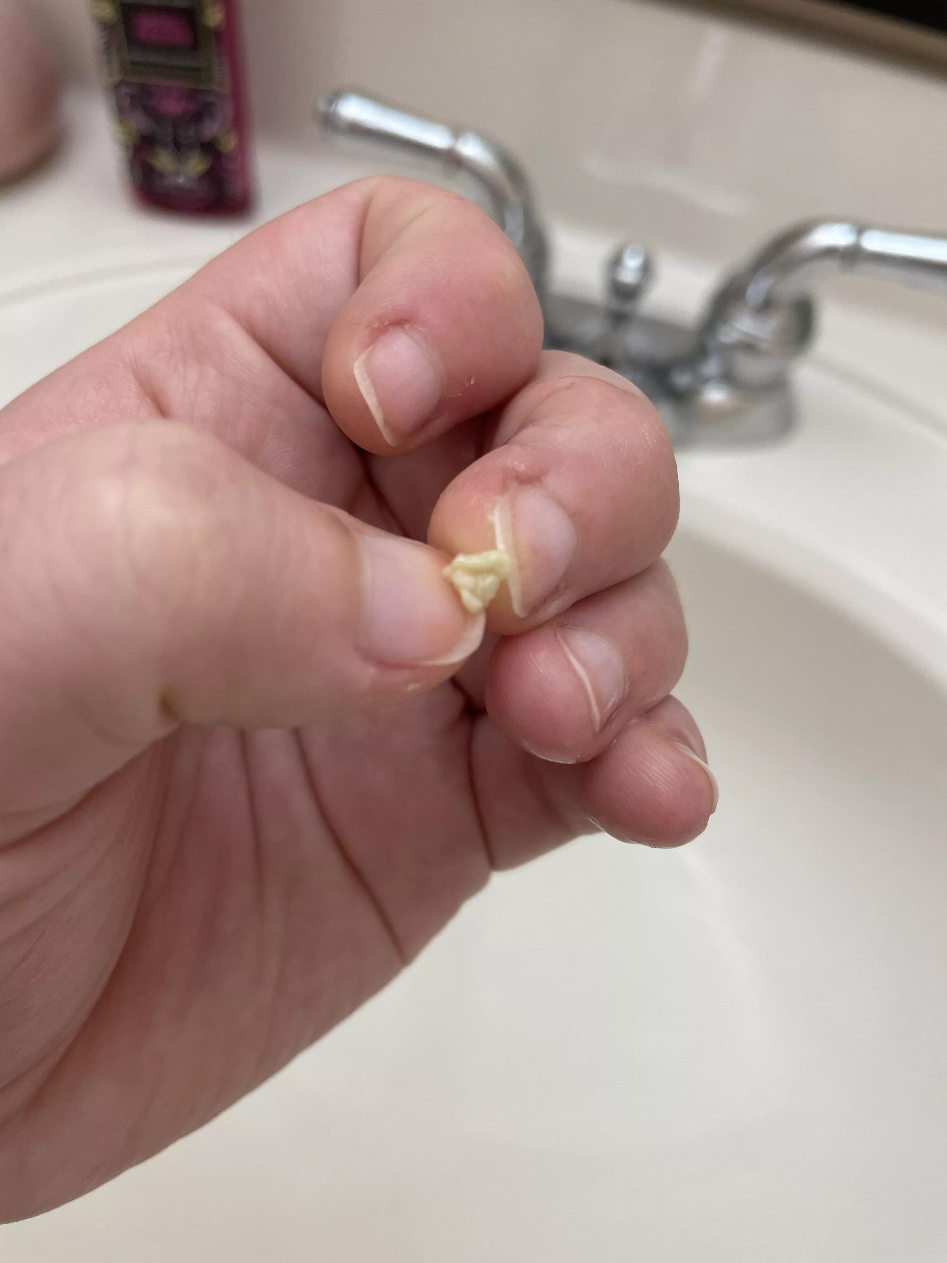 This little guy has been taunting me for days, every time I would try, he just got pushed farther back in my tonsils posted by psychicgayrat