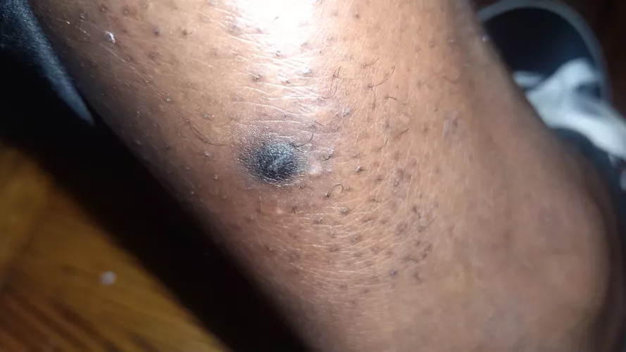 This thing is impossible to pop but so tempting by caseyscolumbusss