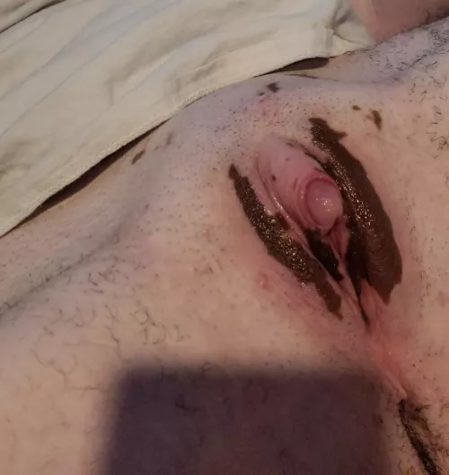 this vitiligo pussy is nice and ready for you by VitiligoFtMboi