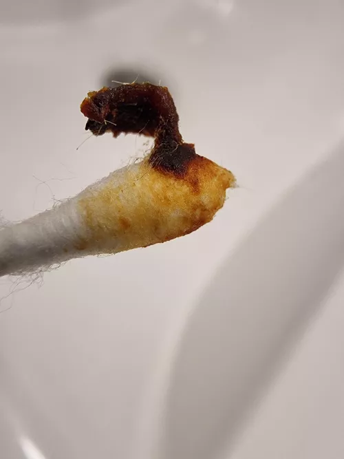 This was extremely satisfying + I can hear better now by babuybastoz