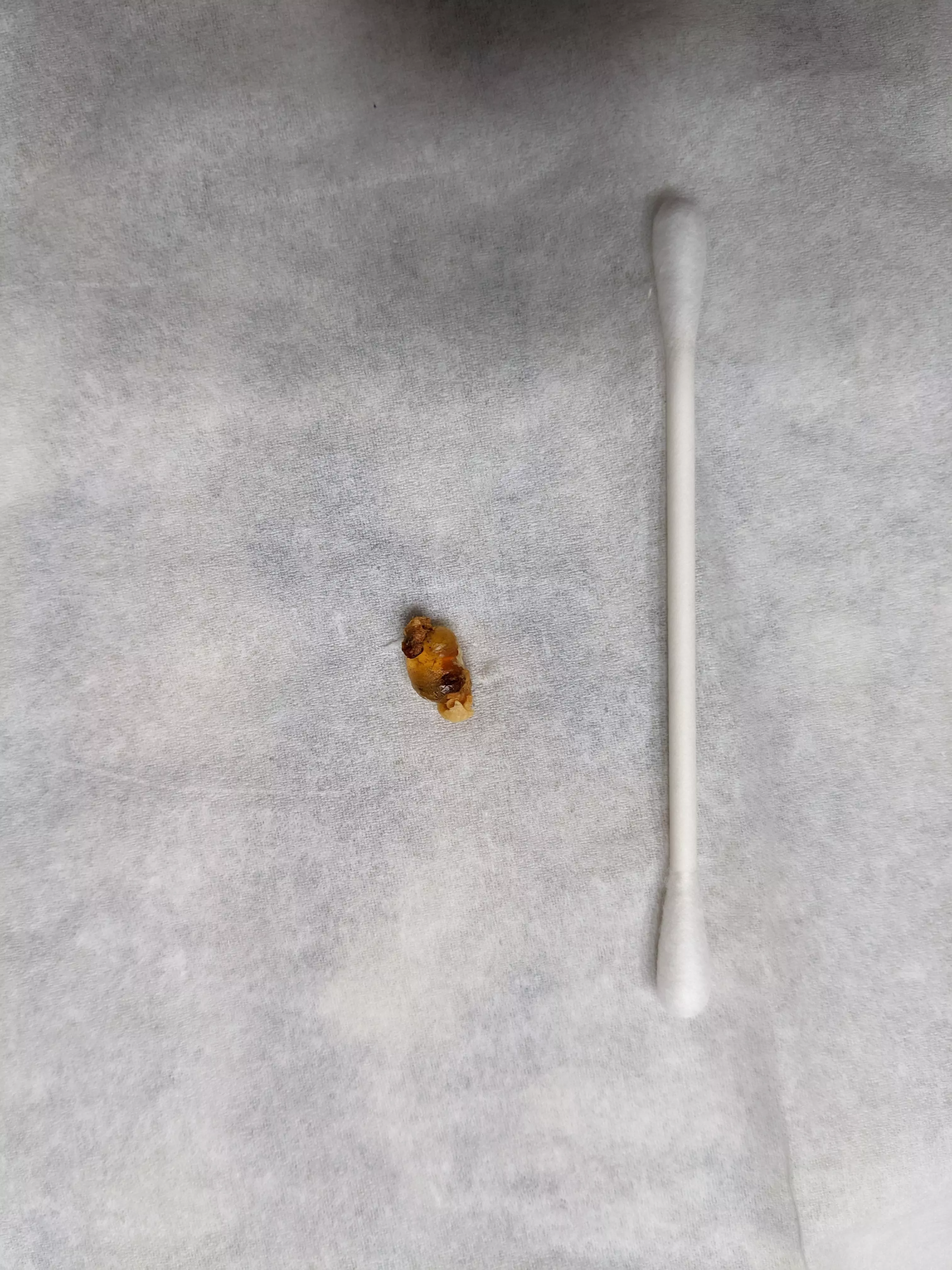 This wax-crusted chunk of what felt like silicone gel we pulled out of my 6YO's ear. posted by elkoubi