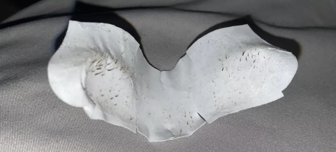 Thought some of you might enjoy my friend’s pore strip. Never expected this by princesspuddin9