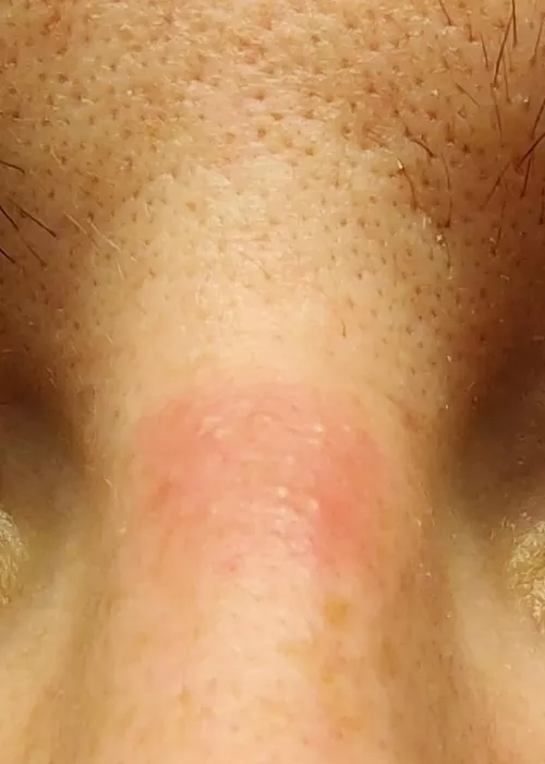 Throwback to my N95 bumps. They were small, but they always made snapping sounds and hit the mirror 💕 by BannedFromWendys