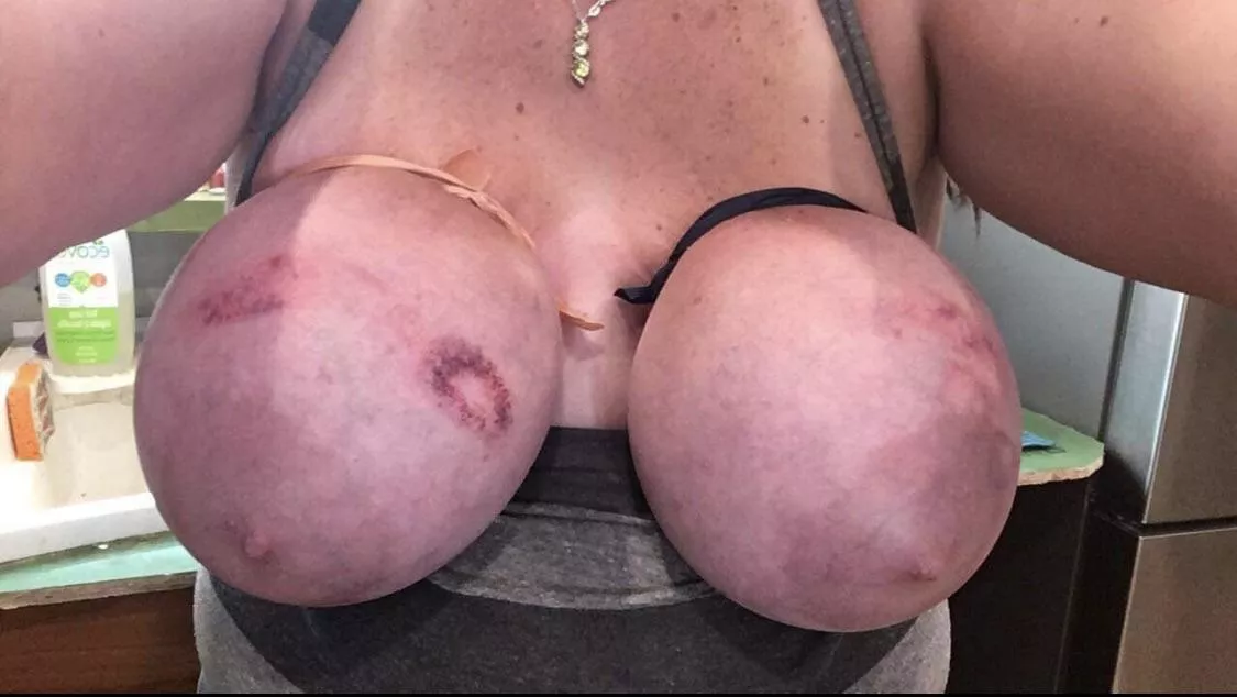 Tied and bruised posted by smokingfetishguy01