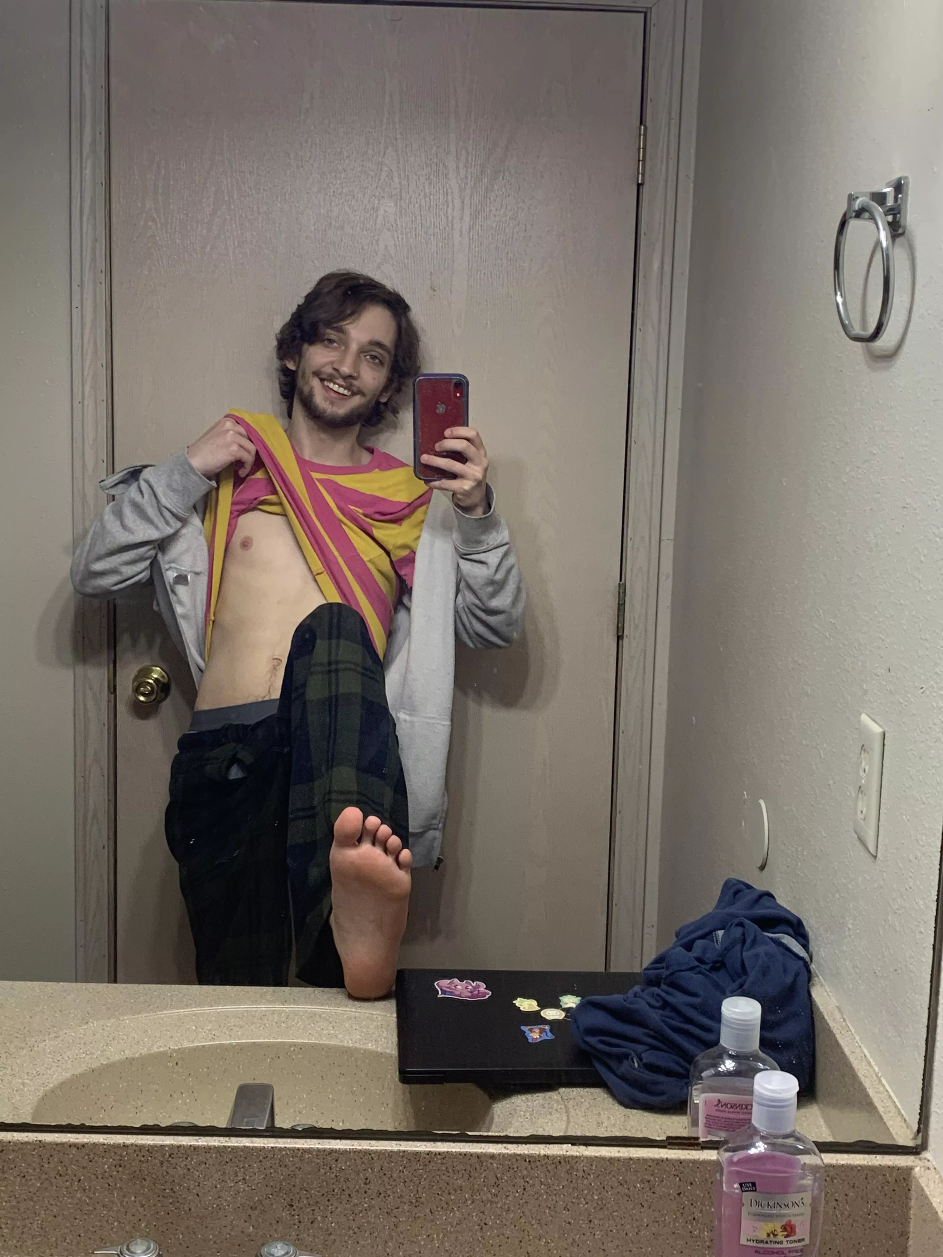 🦶🏻 today posted by AntStinkyFeet