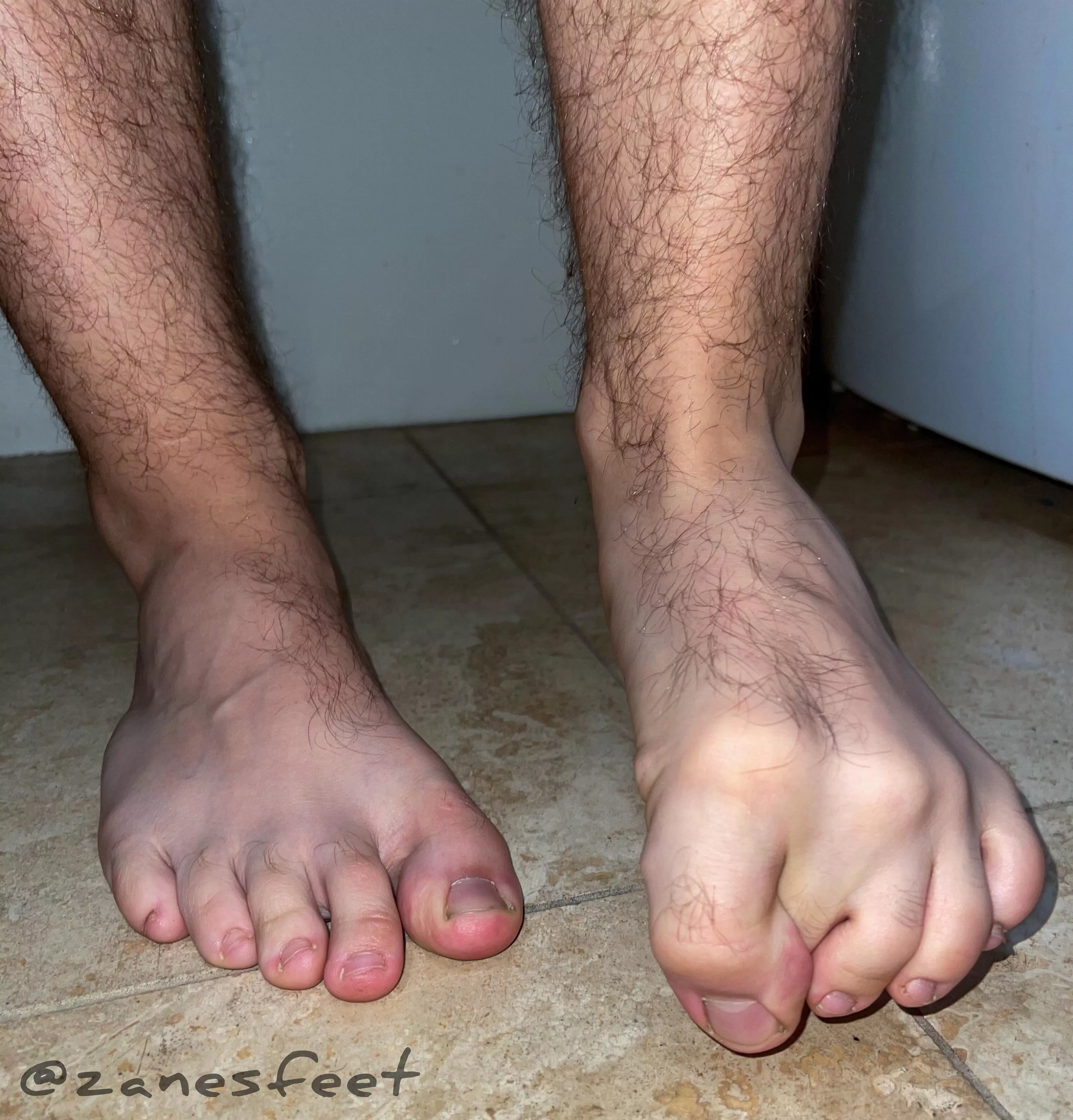 Toes for Friday😇 posted by Zanes-Feet