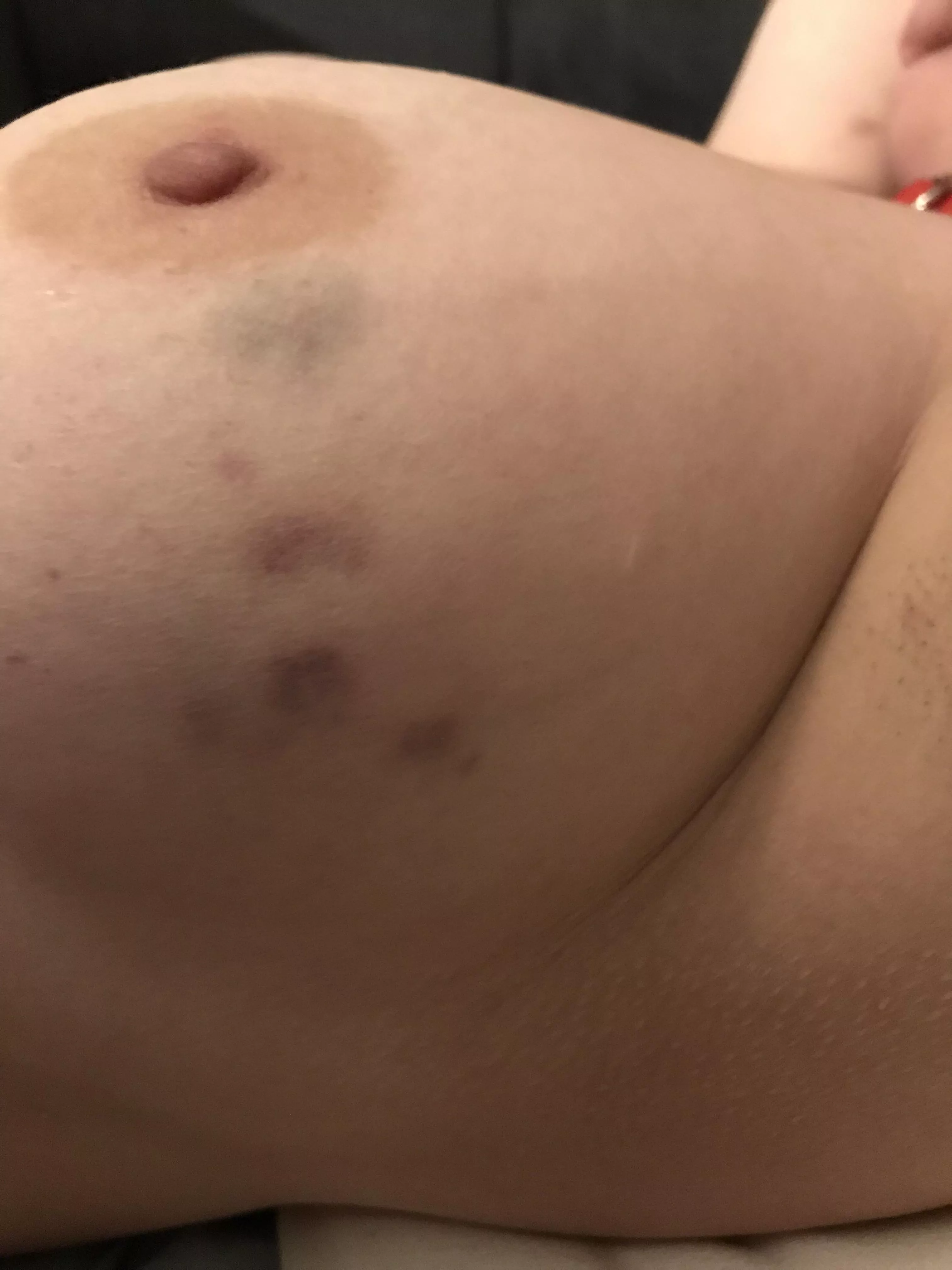 Took a light whipping posted by calm_code_148