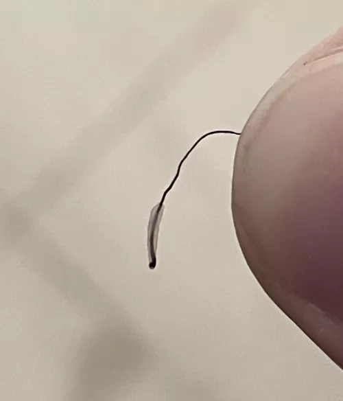Took an ingrown hair out, it came like this by BrerCue