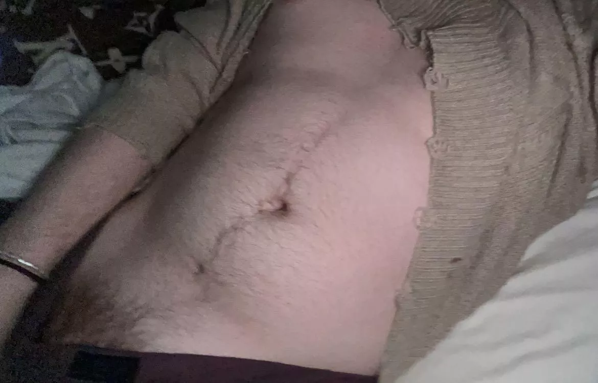 🐌 trail 🙈 (dms open) posted by Message_Guilty