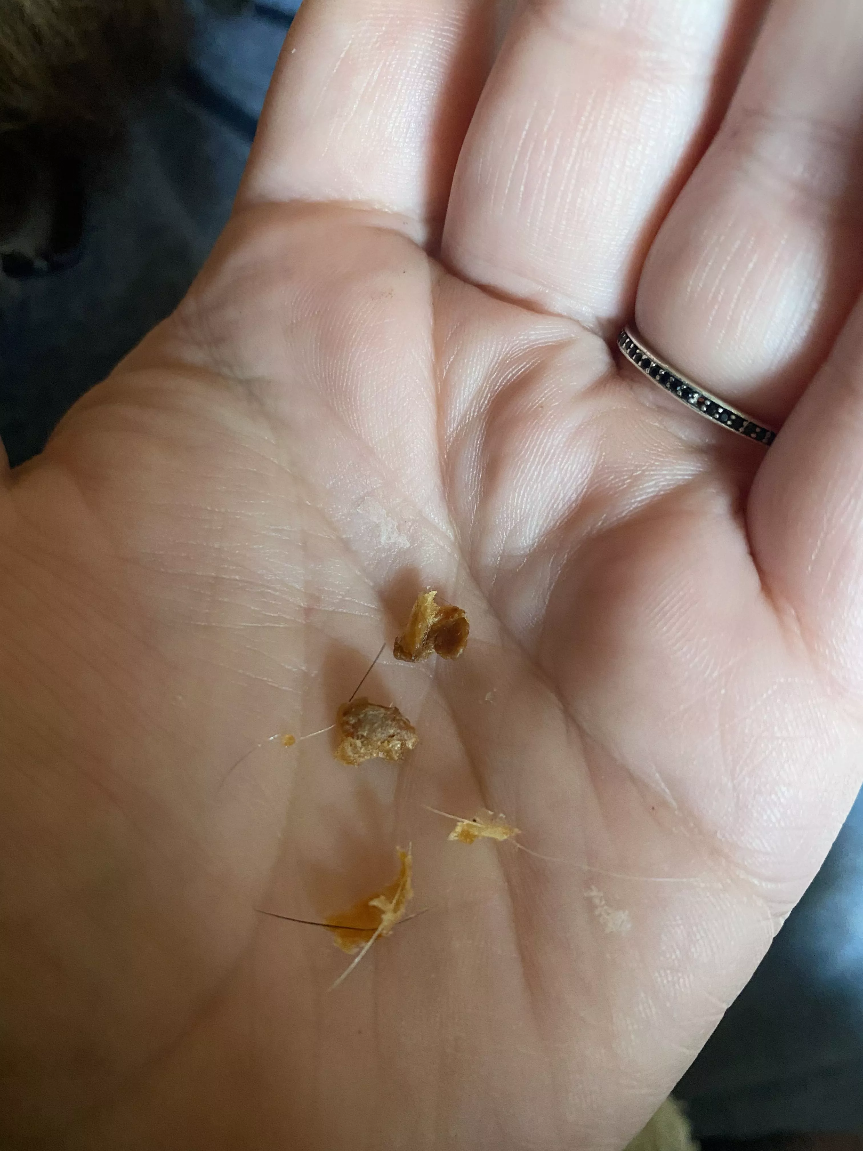 Treasure mine I pulled from my husband’s ear posted by strawbearryblonde