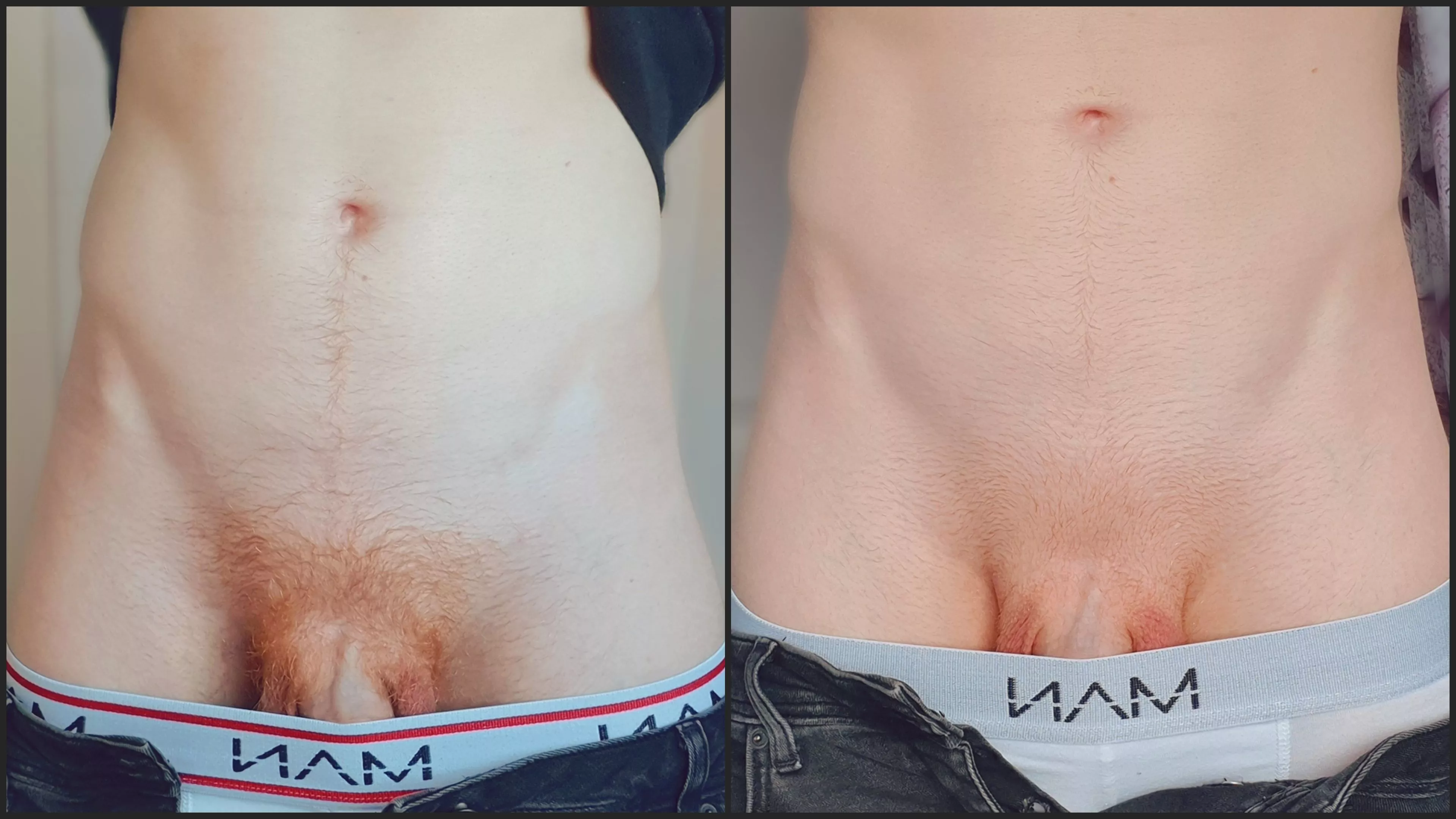 Trimmed or shaved? ✂️ posted by jasperxc