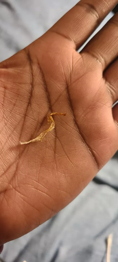 Two Years Later: I have my fourth Ear Wax Sperm!!! (Story and previous posts in comments) by flippermode
