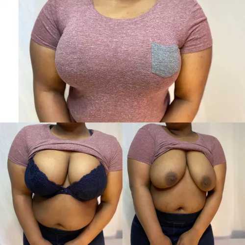 Undress me by it1s_me